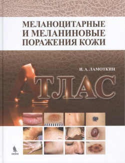 Меланоцитарные и меланиновые поражения кожи: учебное пособие БИНОМ  Лаборатория знаний 9785951805935