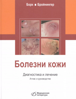 Болезни кожи  Диагностика и лечение Медицинская литература 9785896771777