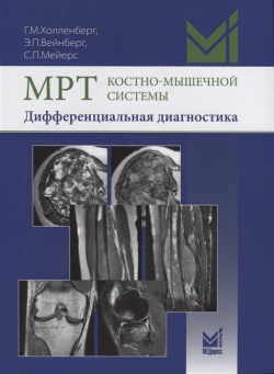 МРТ костно мышечной системы  Дифференциальная диагностика Медпресс информ 978 5 00030 564