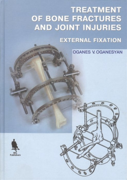 Treatment of Bone Fractures and Joint Injuries  External Fixation (книга на английском языке)