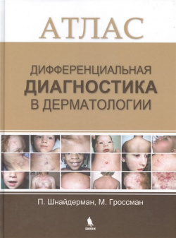 Дифференциальная диагностика в дерматологии  Атлас БИНОМ Лаборатория знаний 978 5 9518 0590 4