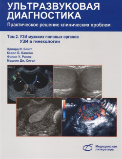 Ультразвуковая диагностика  Практическое решение клинических проблем Том 2: УЗИ мужских половых органов в гинекологии Медицинская литература 978 5 89677 142