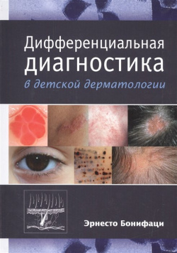 Дифференциальная диагностика в детской дерматологии Издательство Панфилова 978 5 91839 044 3 