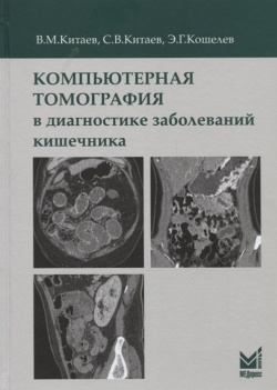 Компьютерная томография в диагностике заболеваний кишечника Медпресс информ 978 5 00 030734 2 