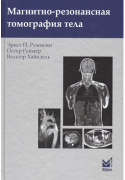 Магнитно резонансная томография тела Медпресс информ 978 5 00030 409 9 Книга